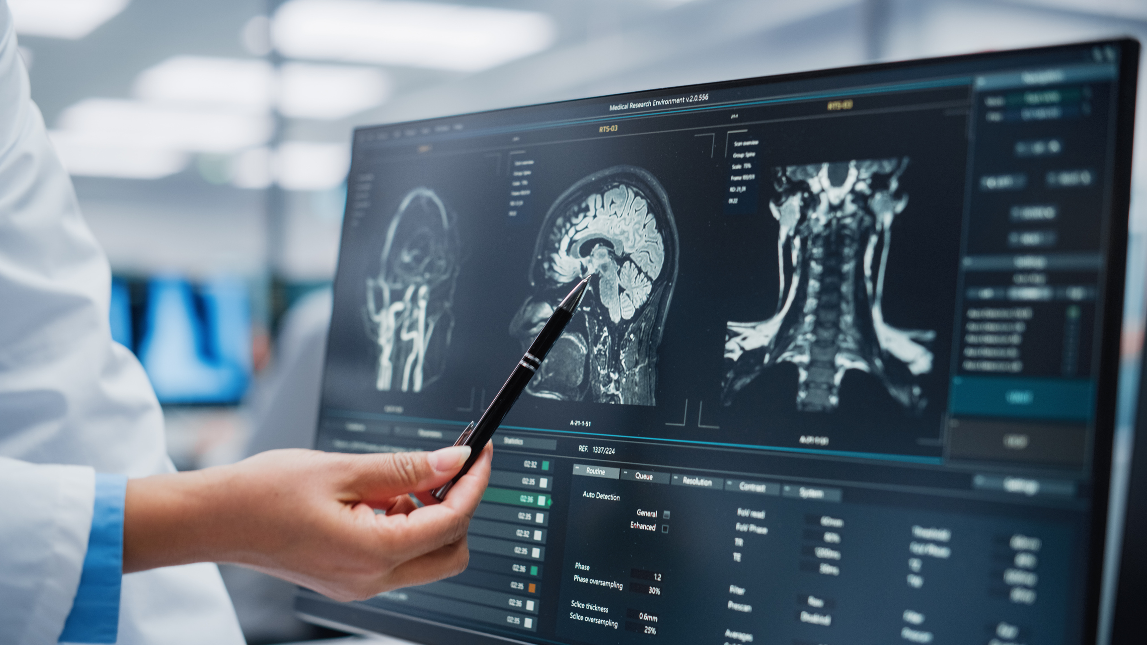 Traumatic Brain Injuries